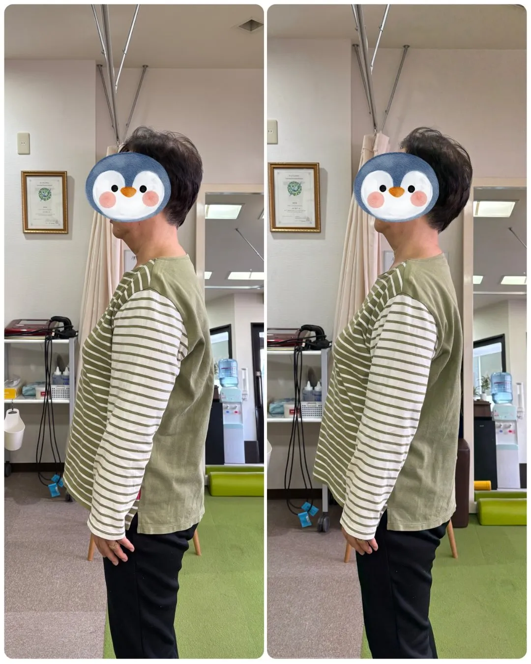 ストレッチポールの体験モニターを実施中です!✨