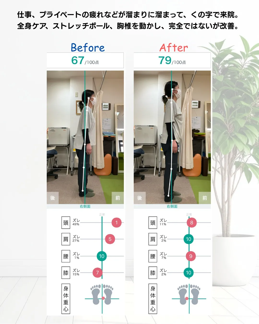 ストレッチポール体験モニターとして施術を受けていただきました...
